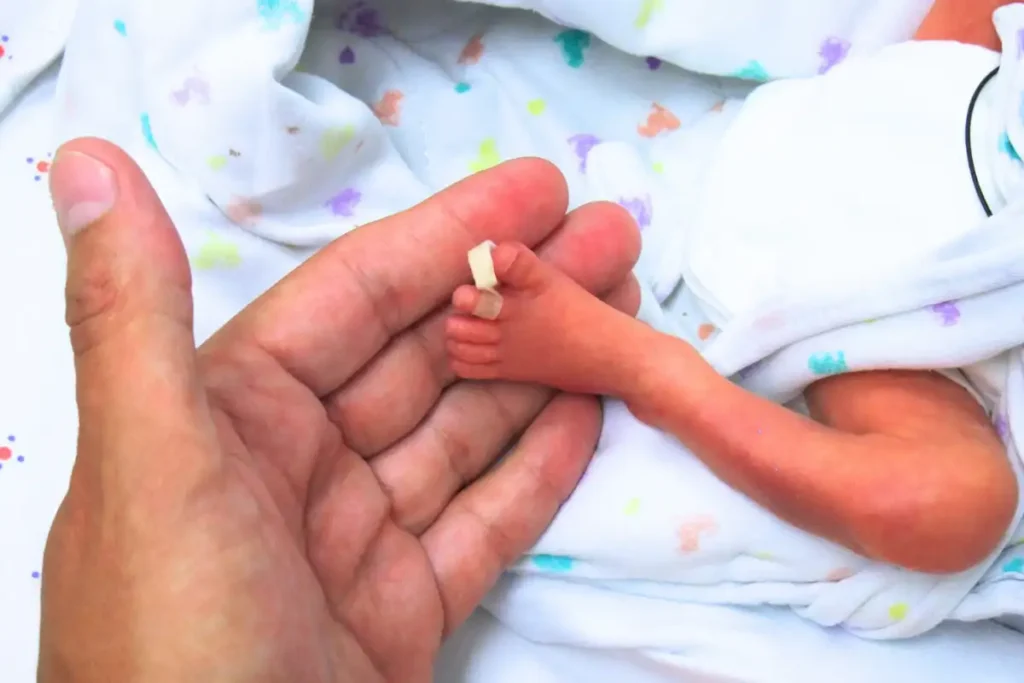 Premature Little Feet
